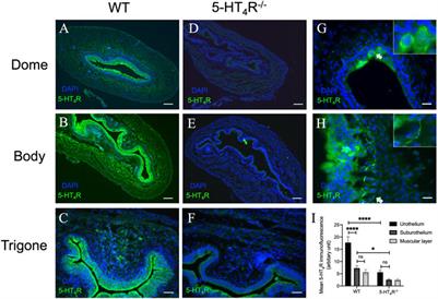 Activation of uroepithelial 5-HT4R inhibits mechanosensory activity of murine bladder afferent nerves